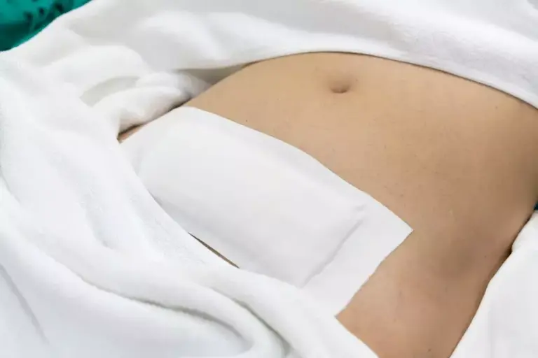What’s the Difference Between Mastectomy and Top Surgery?