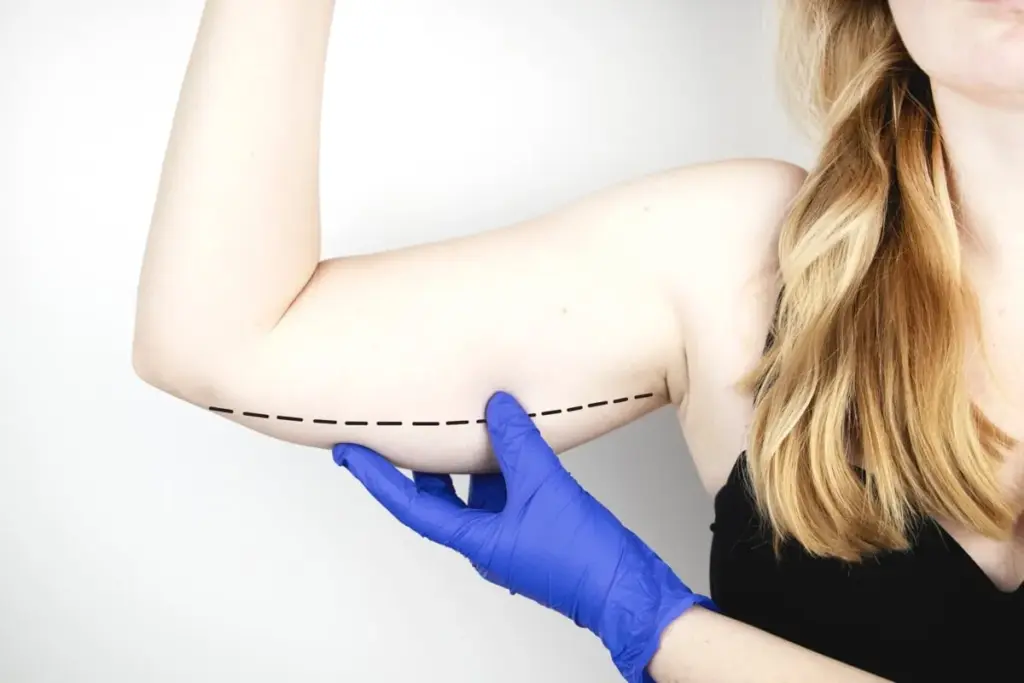 Is Arm Liposuction Dangerous? Safety Risks and Complications Explained