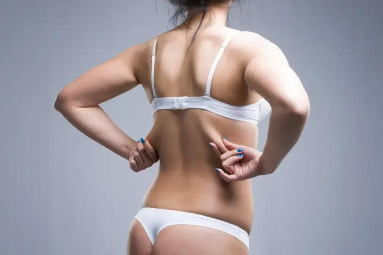 How to Remove Upper Back Fat: A Complete Guide