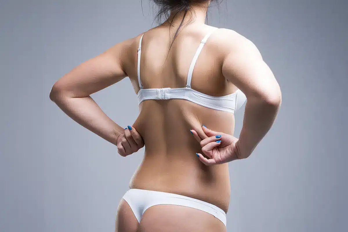 How to Remove Upper Back Fat: A Complete Guide