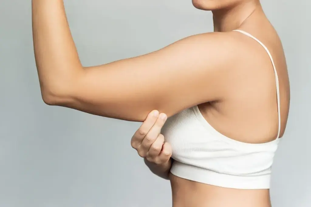How to Reduce Arm Fat: Non-Surgical Solutions