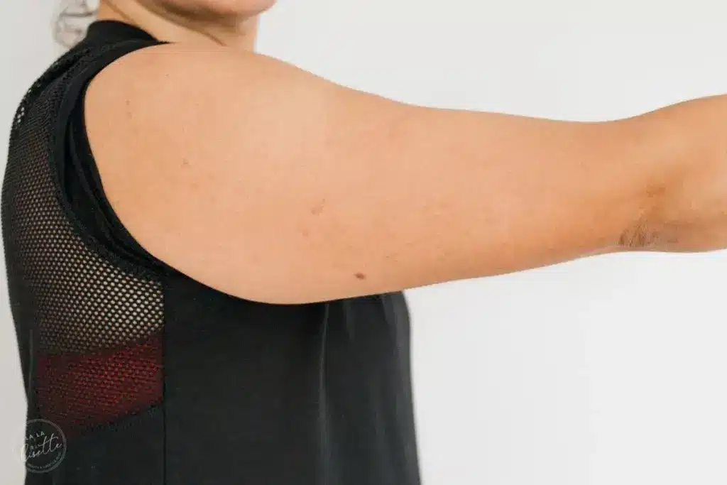 How to Reduce Stubborn Arm Fat: A Complete Guide