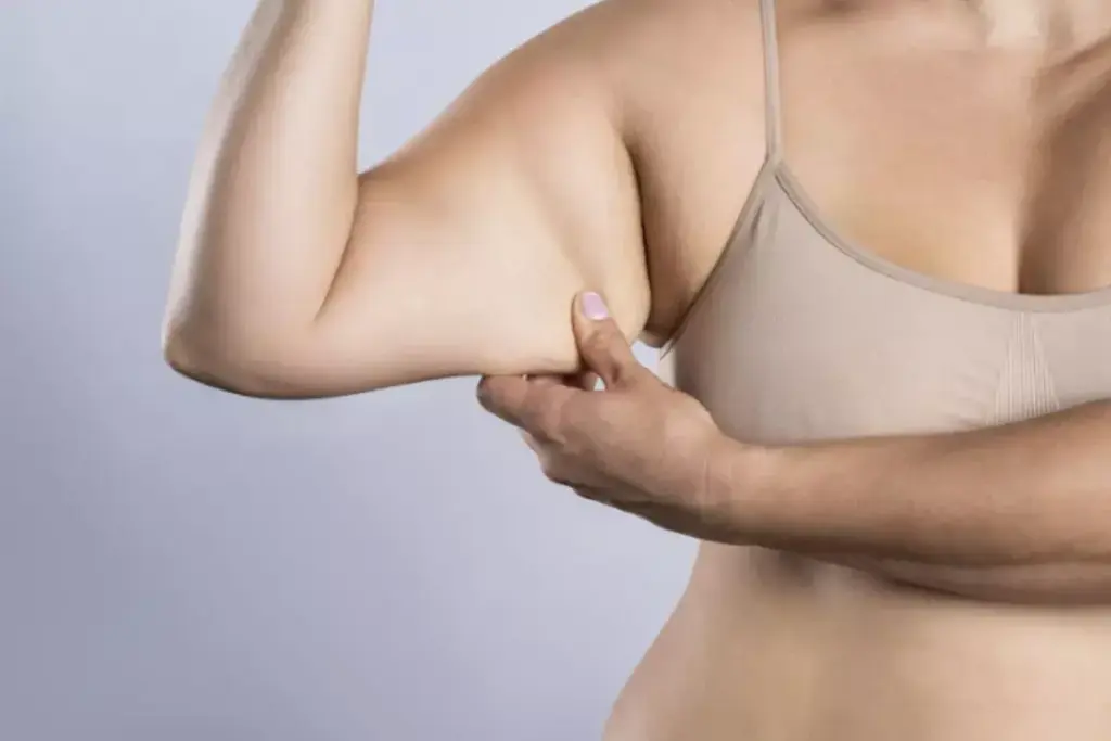How to Reduce Arm Fat with Injections: A Complete Guide 2 How to Reduce Arm Fat with Injections: A Complete Guide