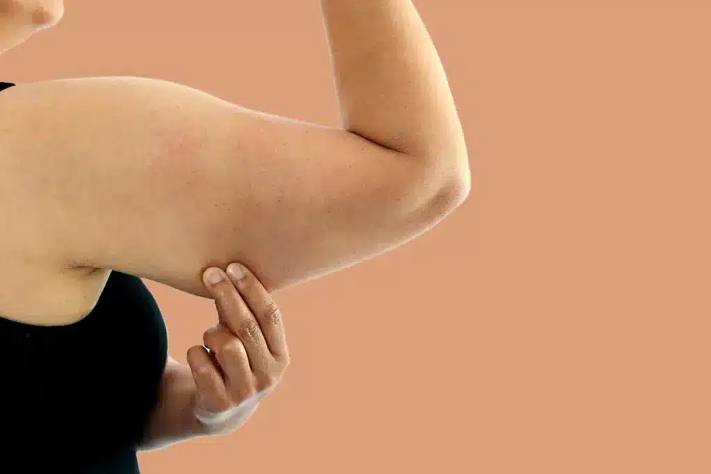 How to Remove Arm Fat with Fat Dissolving Shots