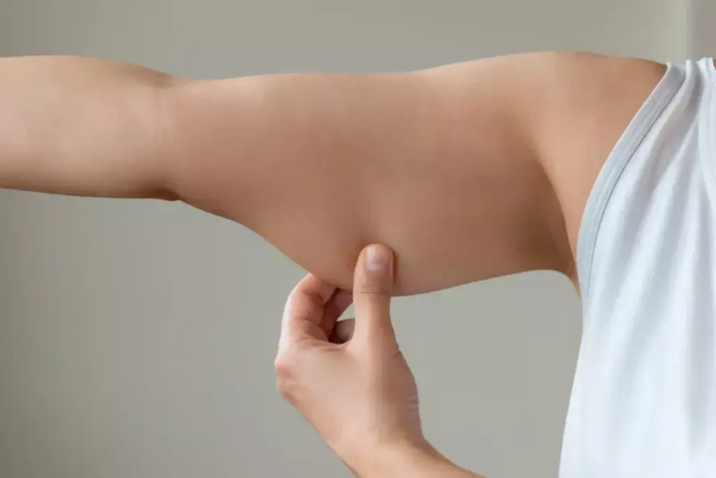 Is Arm Liposuction Safe? Risks, Complications & What to Know