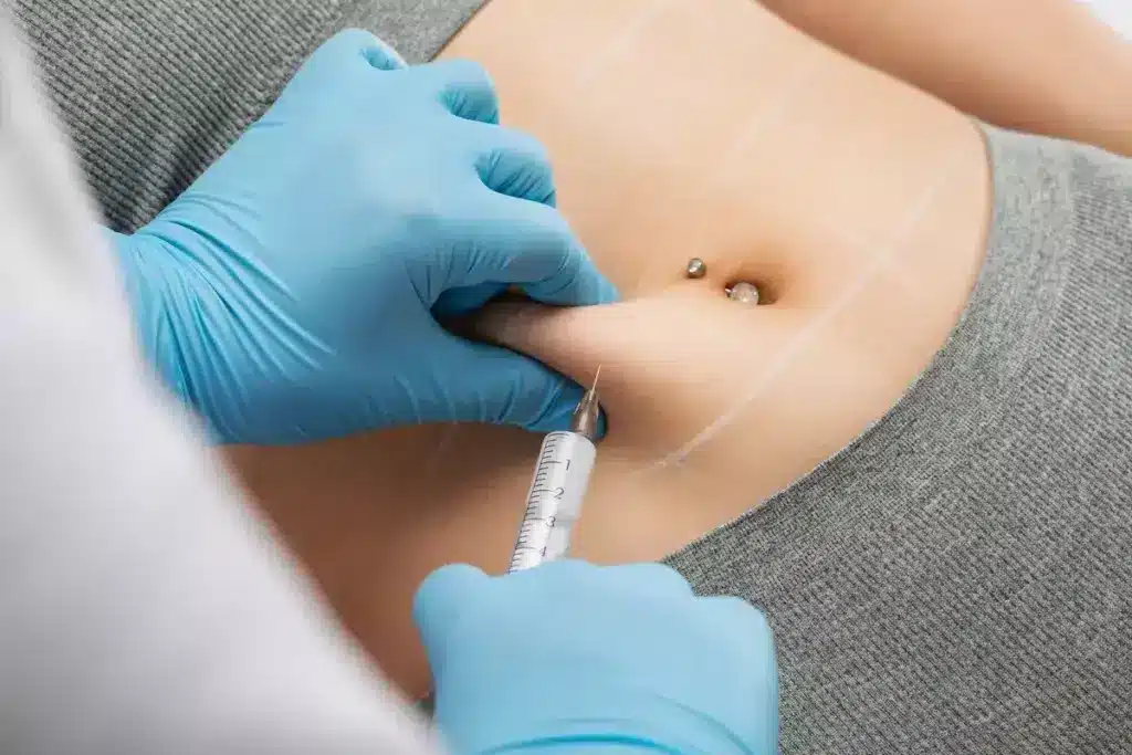 How to Use Fat Melting Injections: Before and After Results 2 How to Use Fat Melting Injections: Before and After Results