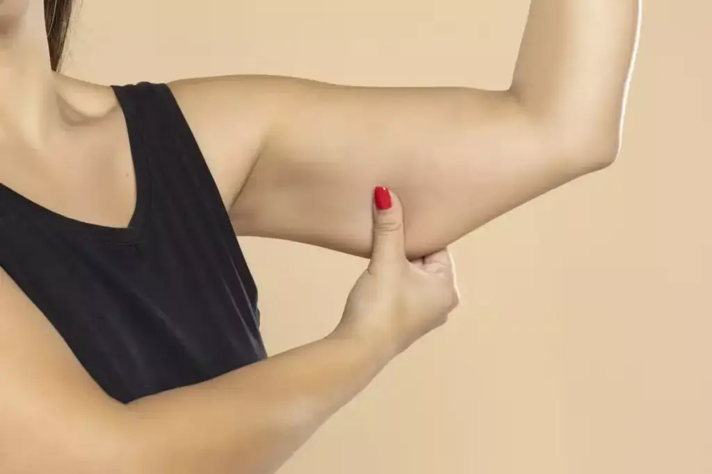 How to Reduce Arm Fat Without Surgery: Non-Invasive Options
