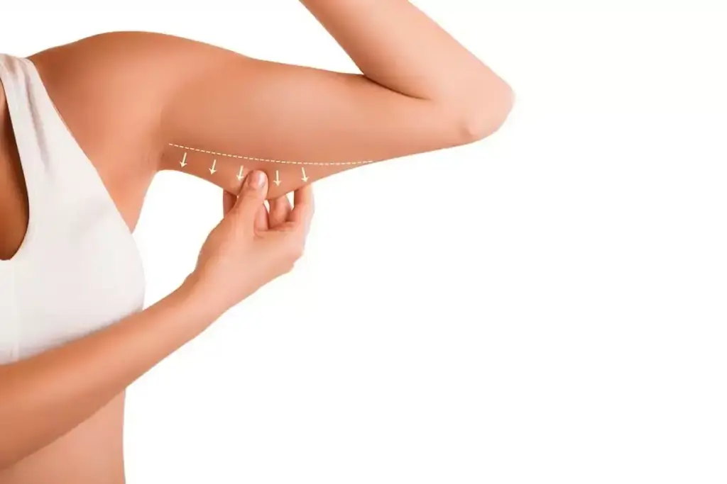 How to Remove Arm Fat Without Surgery: 7 Effective Non-Invasive Options