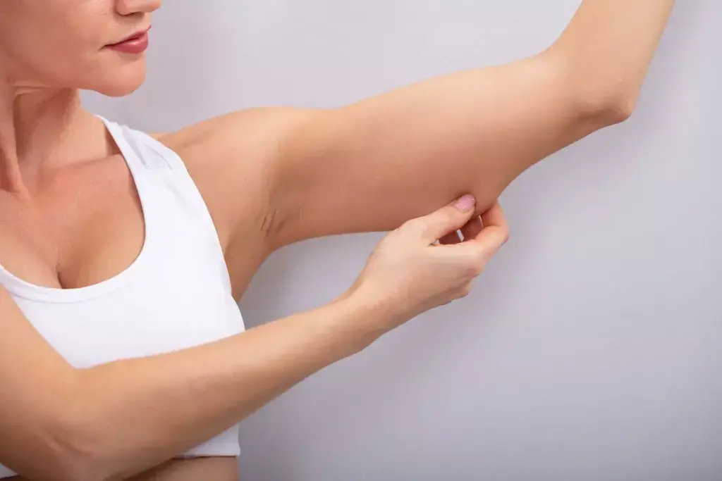 How to Remove Arm Fat Without Surgery: 7 Effective Non-Invasive Options