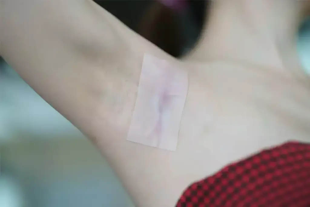 How to Use Silicone Scar Sheets After Surgery