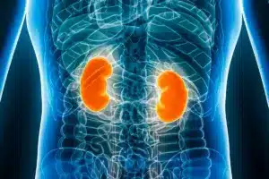 What Does Chronic Kidney Disease Stage 2 Mean?