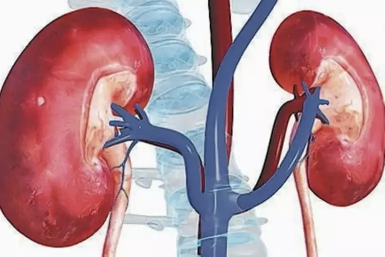 15 Diseased Kidney Pictures: Visual Guide to Kidney Disease Images