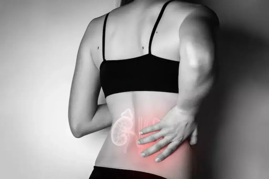 How to Treat Uremic Pruritus: 5 Effective Relief Strategies