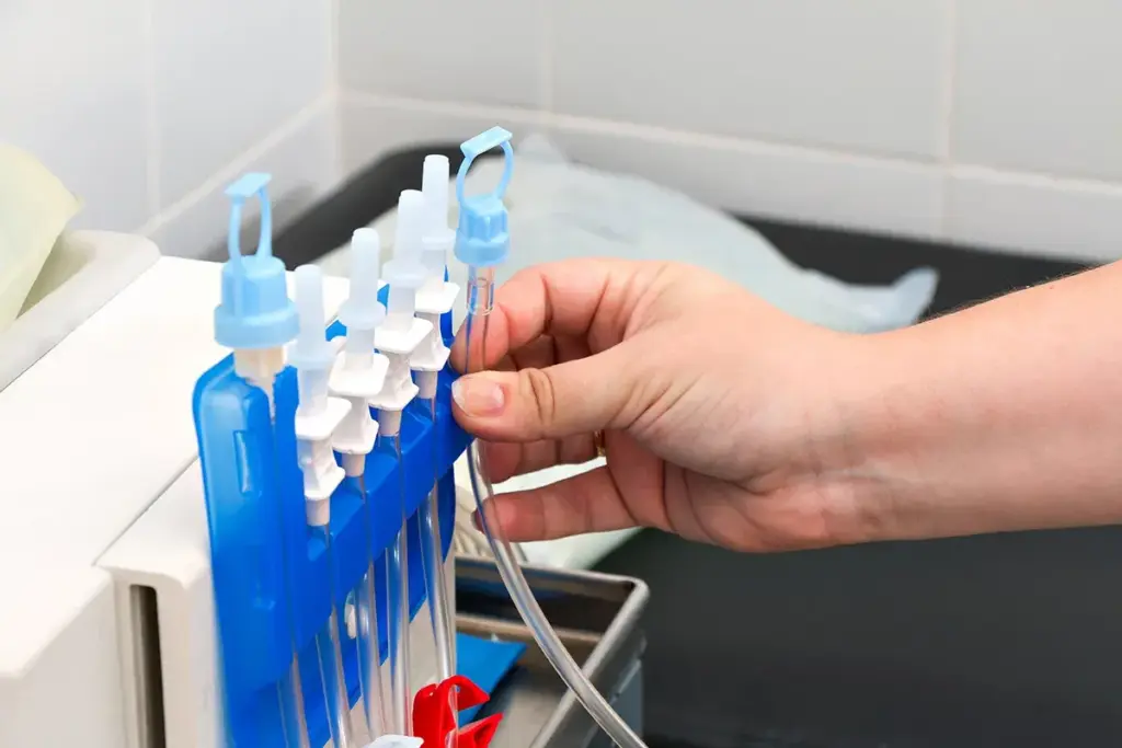 How to Place a Peritoneal Dialysis Catheter: Modified Seldinger Technique