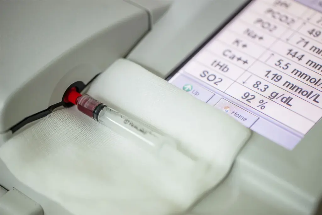 What Is Normal PCO2 Range in Blood Gas Tests?