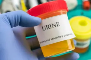Why Is My Urine Foamy and When Should I Worry?