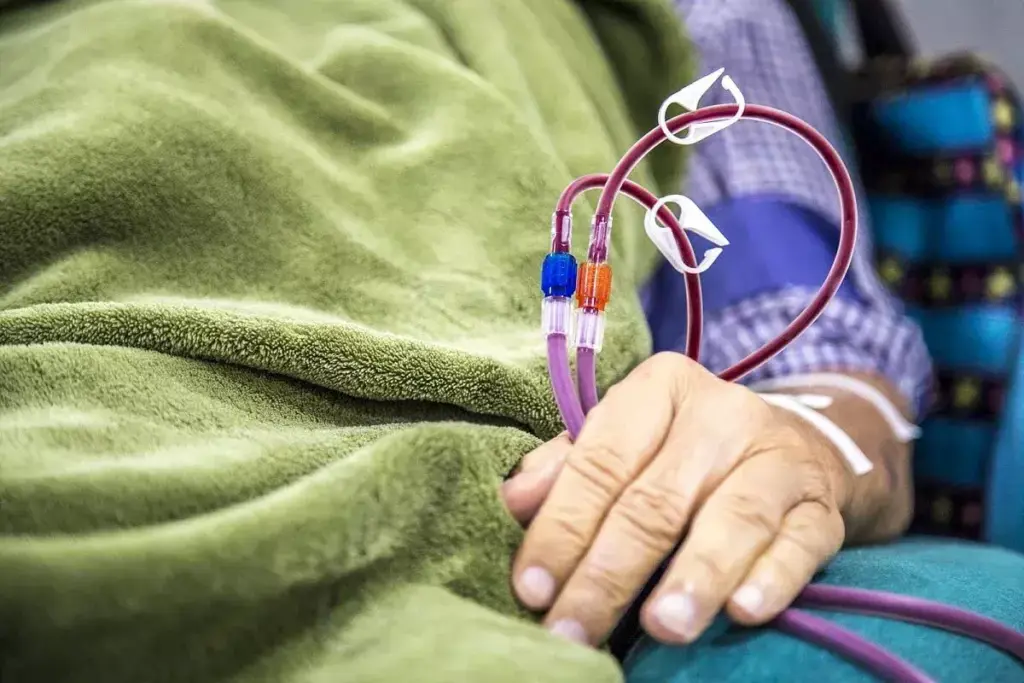 4 Types of Dialysis Access: Fistulas, Grafts & Shunts