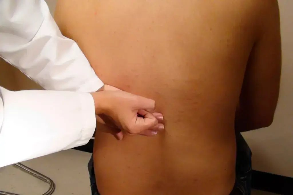 How to Treat Acute Pyelonephritis: Complete Guide