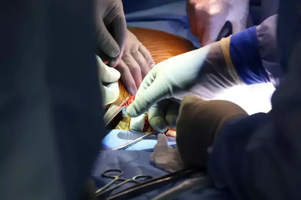 How Long Does Recovery Take After a Kidney Transplant?