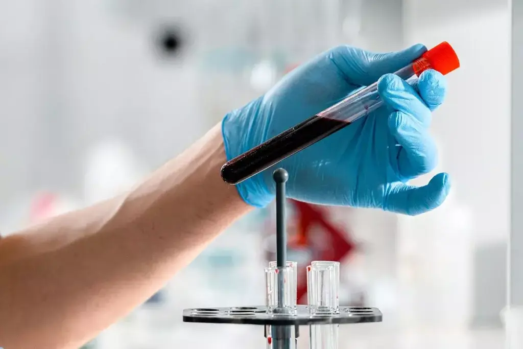 How to Test for Kidney Failure: Complete CKD Lab Guide