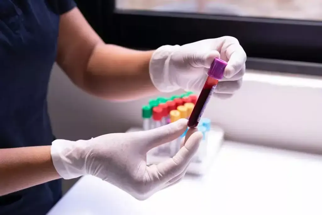 How to Test for Kidney Failure: Complete CKD Lab Guide