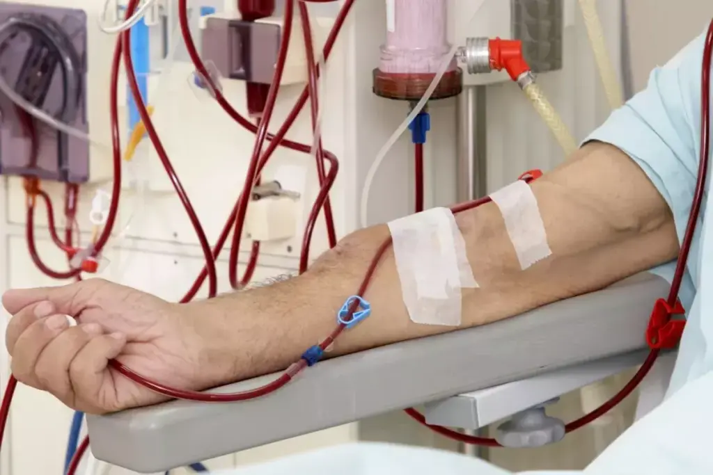Does Blood Transfusion Help Improve Kidney Function?