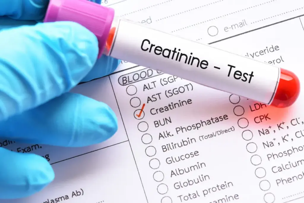Where Does Creatinine Come From and What Do High Levels Mean? 1 Where Does Creatinine Come From and What Do High Levels Mean?