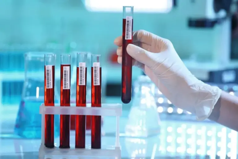 What Does High Chloride Mean in Your Blood Test?