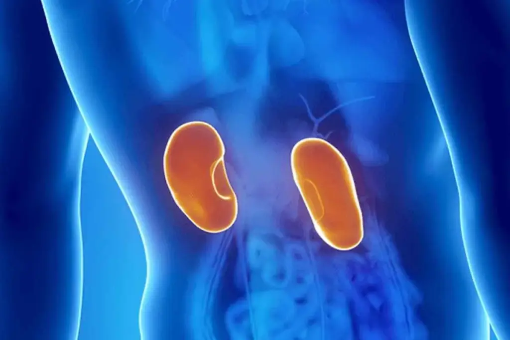 How to Live With One Kidney: A Complete Guide