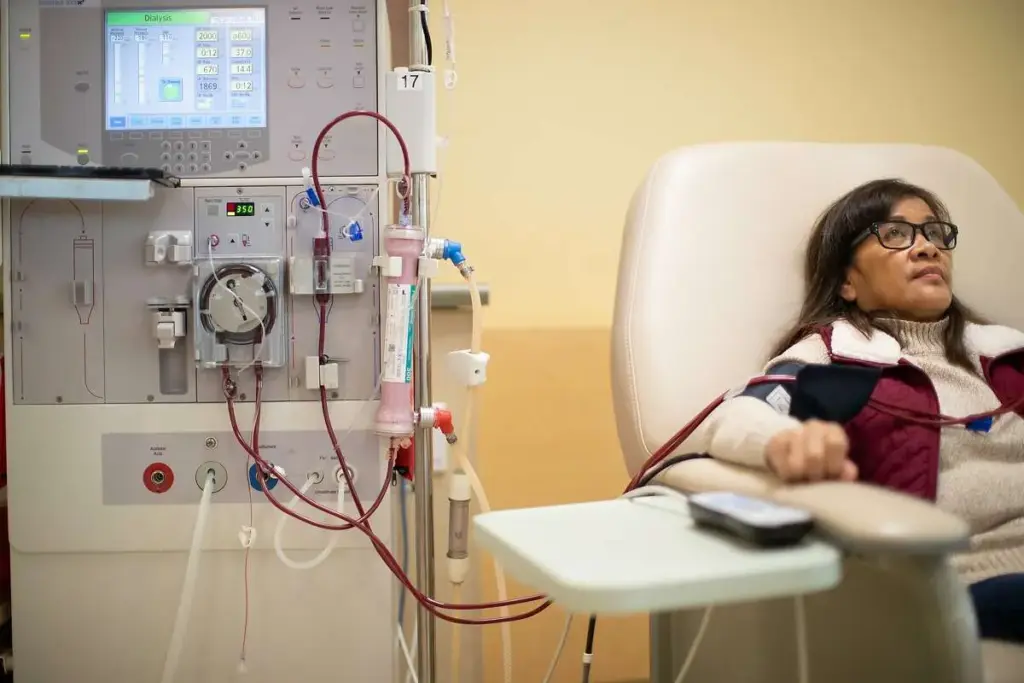 Can You Survive Without Kidneys? What Medical Science Reveals