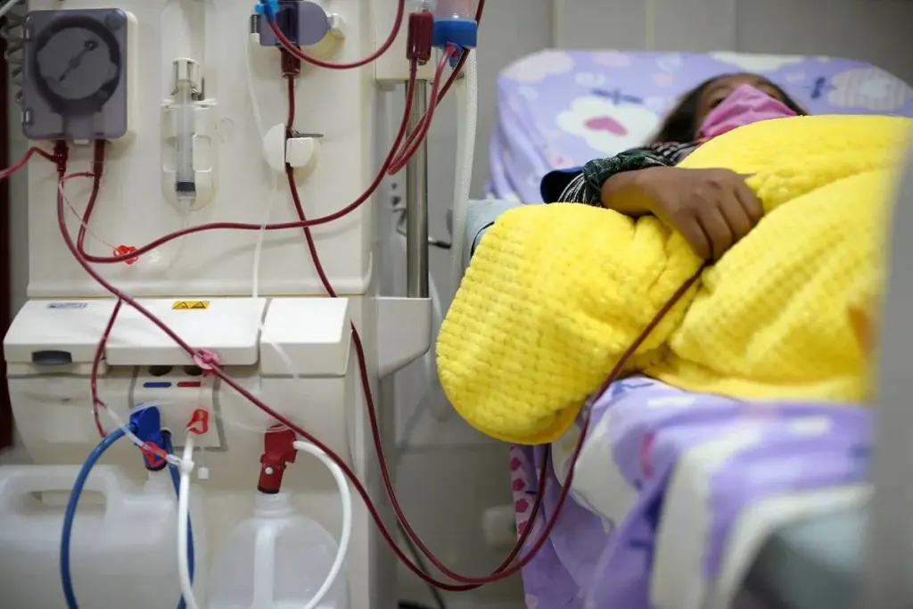 How to Create an AV Fistula for Dialysis: Step-by-Step