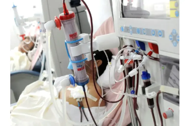 How to Create an AV Fistula for Dialysis: Step-by-Step