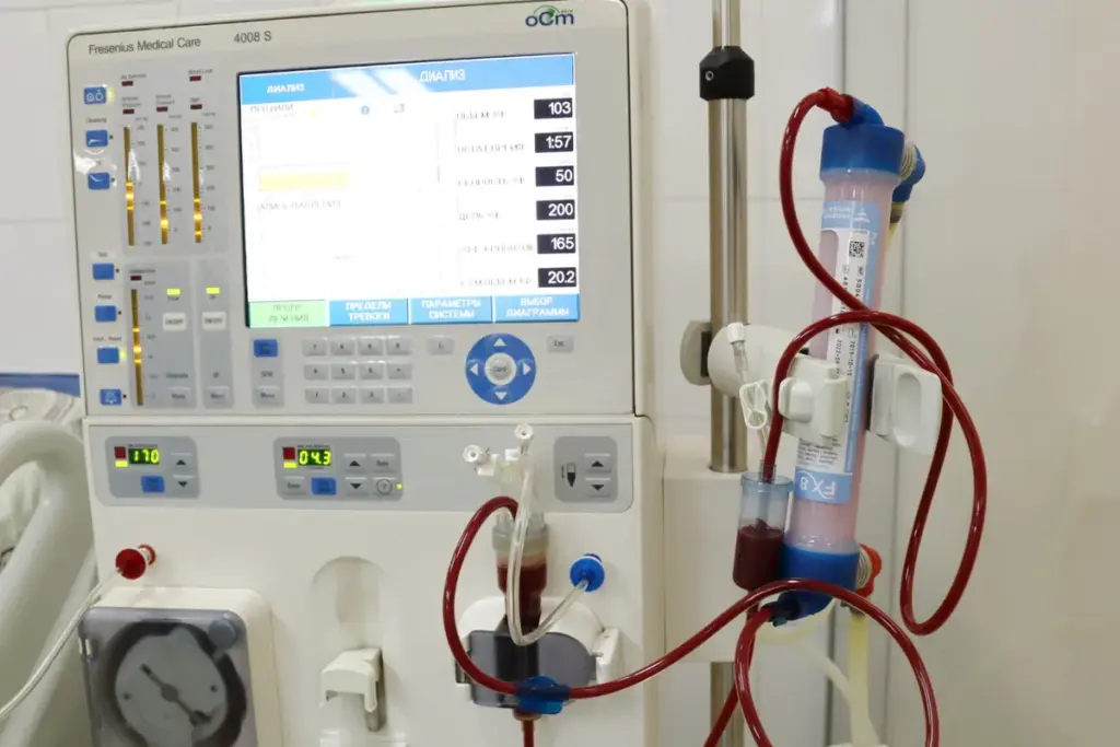 How to Choose a Kidney Dialysis Port for Hemodialysis Access