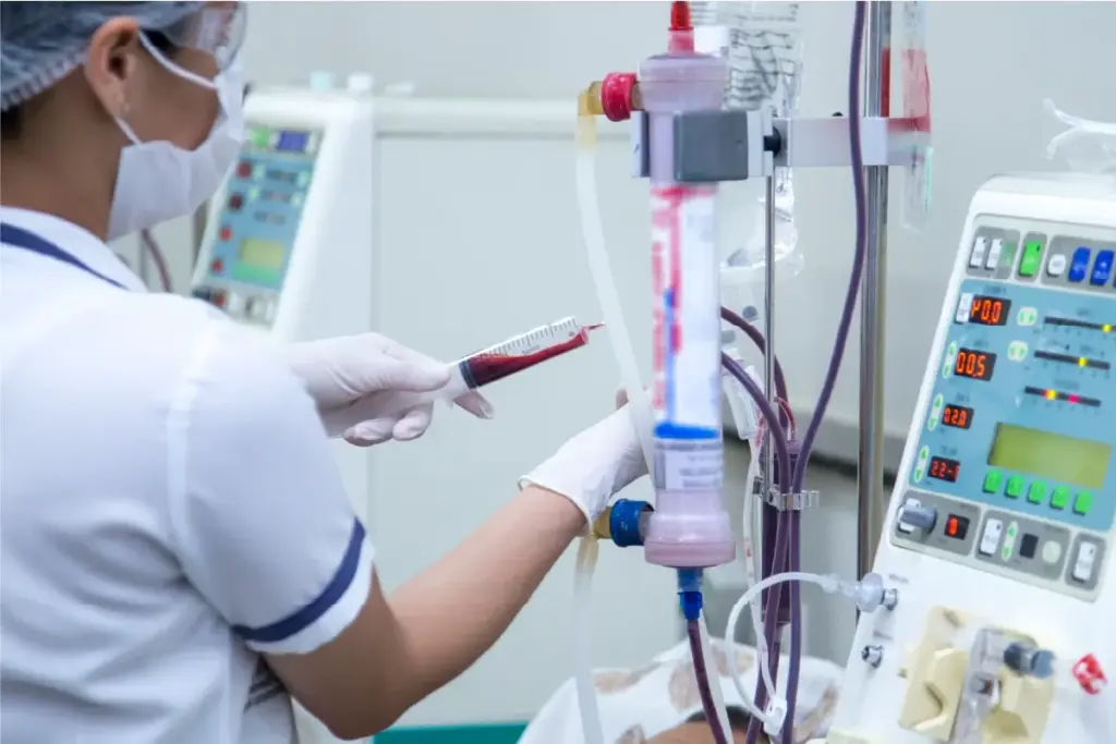 How to Get an AV Fistula for Dialysis: Complete Guide