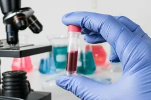 What Causes Low Anion Gap in Blood Tests?