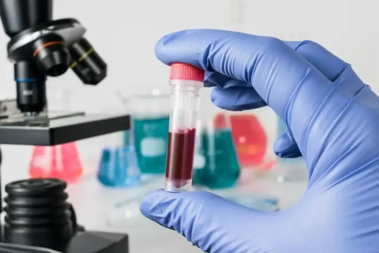 What Causes Low Anion Gap in Blood Tests?