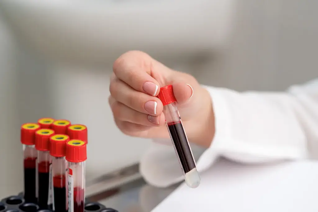 A detailed illustration of an anion gap calculation in blood chemistry. In the foreground, a close-up view of a clinical blood work report, focused specifically on the anion gap section, with numbers and colorful graphs indicating various rows and columns. The middle ground shows a lab technician in professional attire, thoughtfully analyzing the report, with a microscope and vials of blood samples beside them. In the background, a modern laboratory setting with soft, diffused lighting, reflecting a sterile and sophisticated environment. The overall mood is educational and professional, aiming to convey a sense of inquiry and understanding in medical science. High-resolution, shot with a 50mm lens to create a clear and detailed focus on the report while gently blurring the background elements. What Causes Low Anion Gap in Blood Tests?