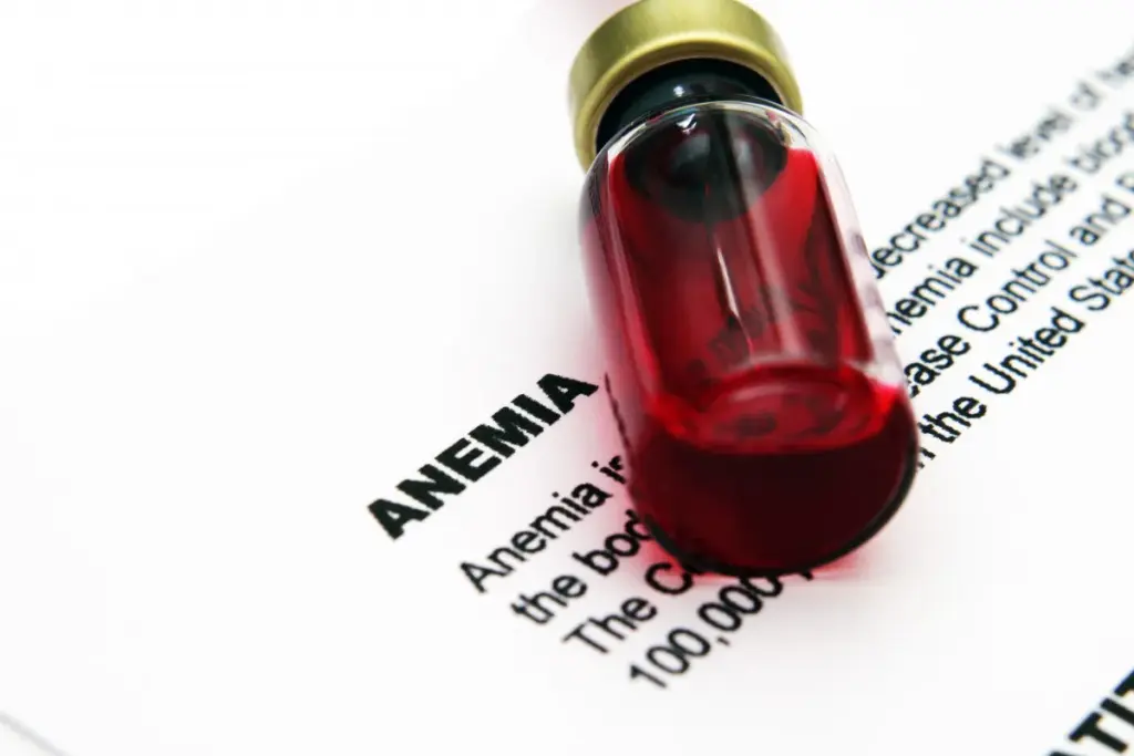 How to Treat Anemia in Dialysis Patients