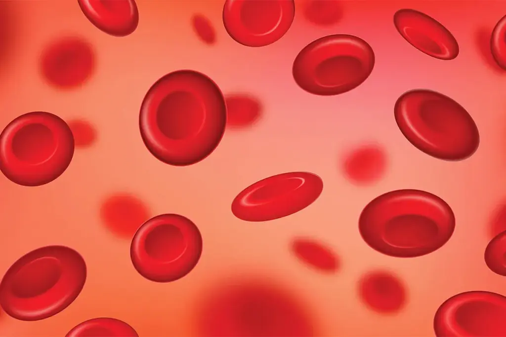 5 Key Treatments for Anemia in CKD: Managing ESRD Effectively 2 5 Key Treatments for Anemia in CKD: Managing ESRD Effectively