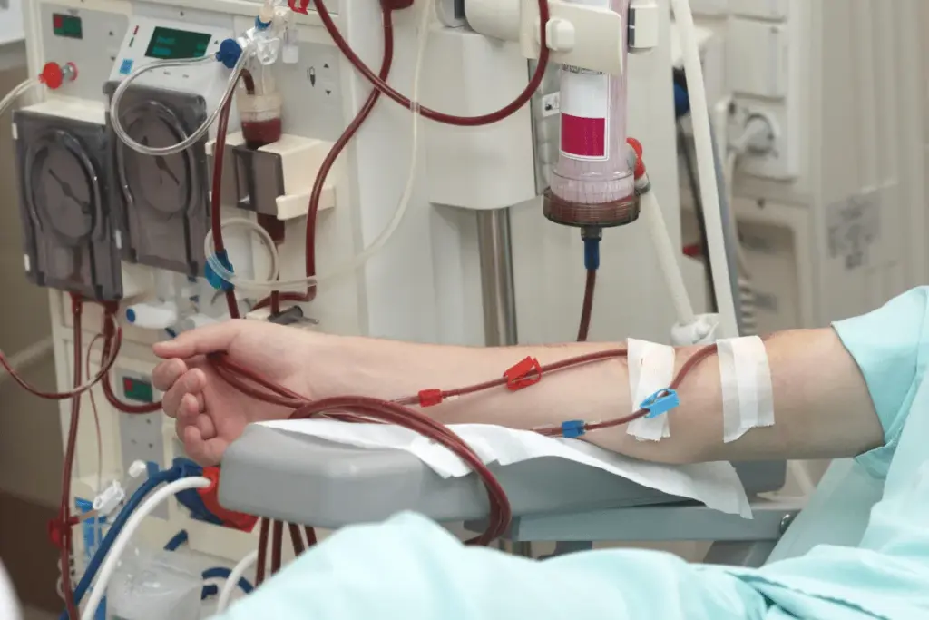 How to Get Off Dialysis: Treatment Alternatives