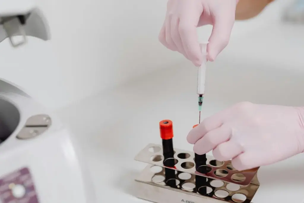 A detailed scientific illustration showing the function of albumin in blood. In the foreground, visualize a close-up of plasma with albumin molecules depicted as yellow oval shapes, interacting with various substances like hormones and fatty acids. The middle ground should feature a stylized red blood cell, emphasizing its role in oxygen transport. In the background, depict a gradient of blue and green representing the bloodstream environment, with gentle light rays filtering through to create a vibrant and dynamic atmosphere. Use soft focus for the background while keeping the foreground sharp, simulating a macro photography effect. The overall mood should be educational and informative, reflecting the intricate role of albumin in maintaining blood functions, under bright, clear lighting. What Does High Albumin in Blood Tests Mean?