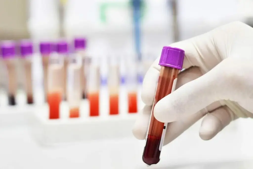 What Is Albumin in Blood Tests and What Do Your Levels Mean? 1 What Is Albumin in Blood Tests and What Do Your Levels Mean?