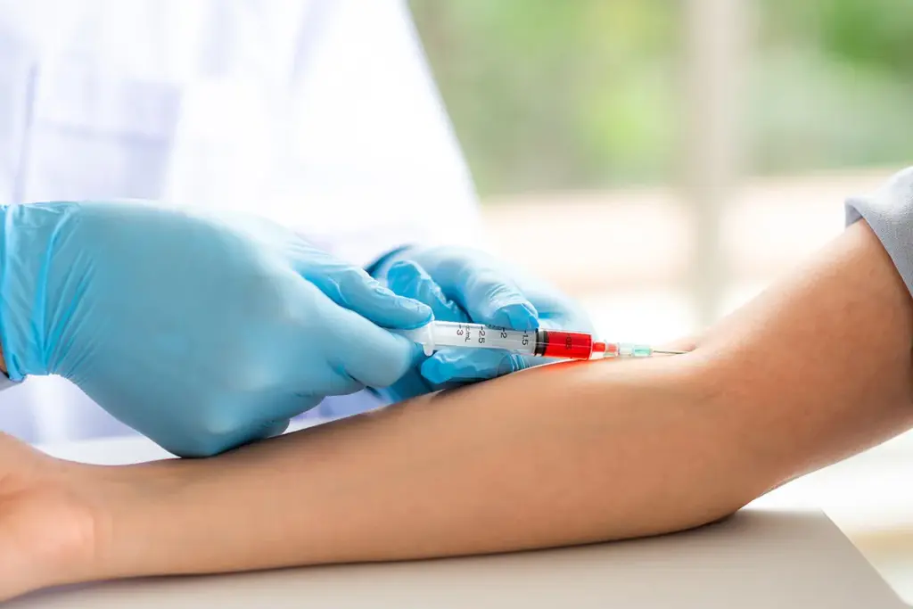 A detailed cross-section of human blood showcasing albumin molecules actively interacting with various blood components. In the foreground, vividly portrayed albumin proteins in a rich yellow color, with molecular structures highlighted to illustrate their role in transporting substances and maintaining osmotic pressure. In the middle, a dynamic flow of red blood cells and platelets, emphasizing the importance of albumin in overall blood health. The background features a soft-focus of a laboratory setting with glass test tubes and scientific equipment, bathed in natural light to create an inviting atmosphere. Use a macro lens to capture intricate details, and maintain a professional and informative mood, ensuring clarity without clutter. What Is Albumin in Blood Tests and What Do Your Levels Mean?