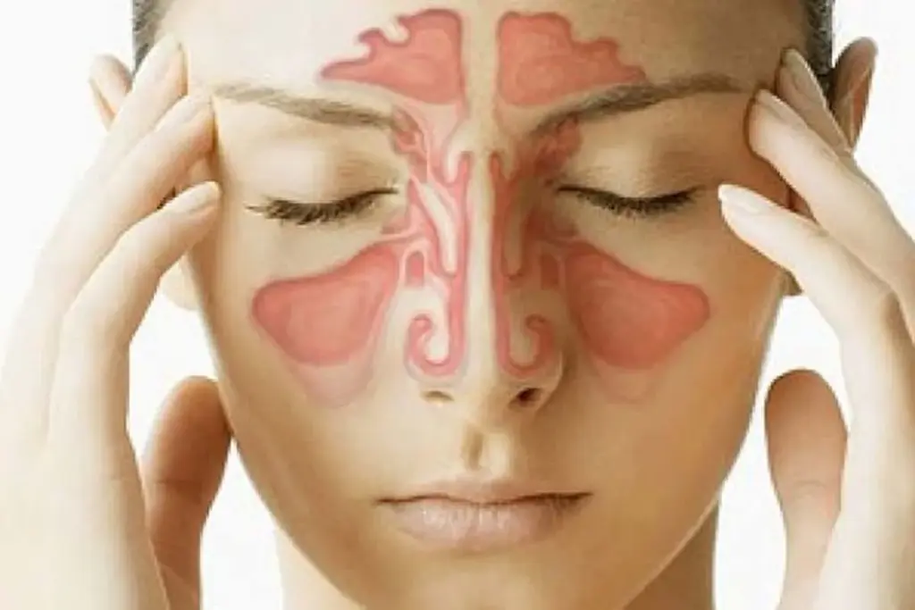 Nasal polyps: Dangerous ultimate secrets. 1 Nasal polyps: Dangerous ultimate secrets.