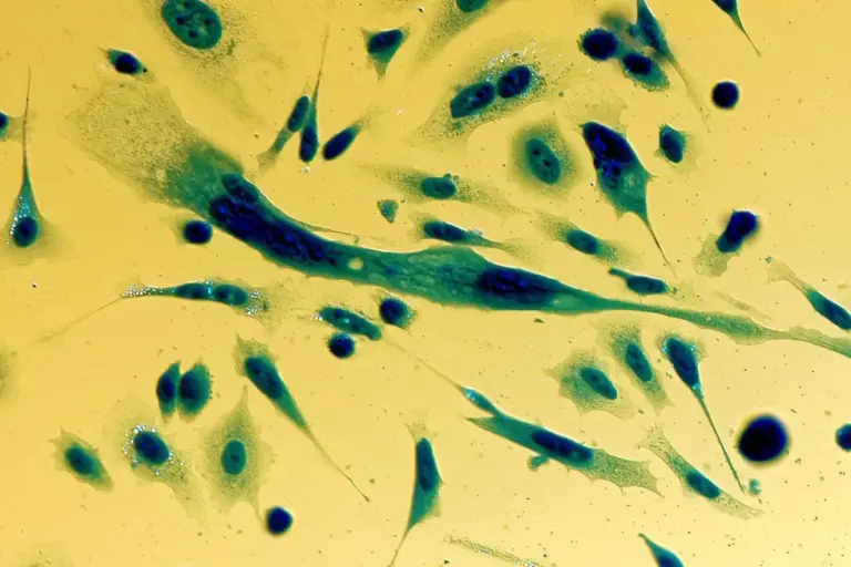 Recovery From Prostate Biopsy: Healing Guide