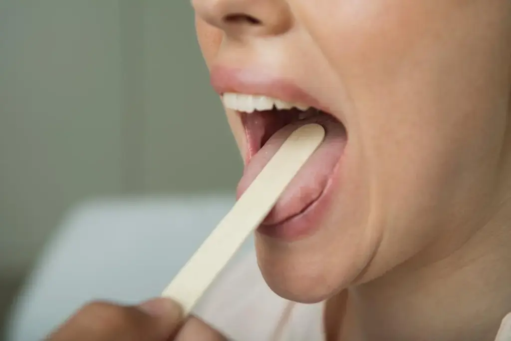 Tonsillectomy procedure: Easy guide.