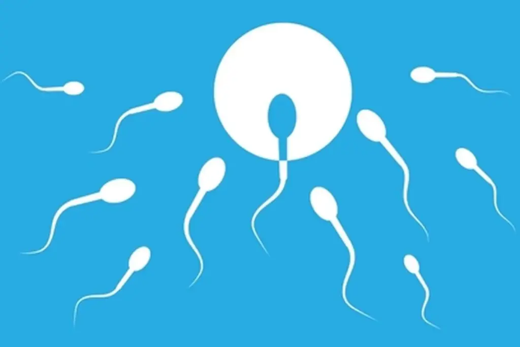 Male Infertility: Diagnosis and Solutions