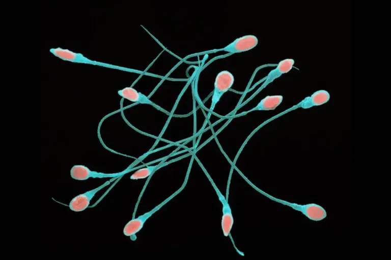 Edging: Meaning, Benefits, and Techniques