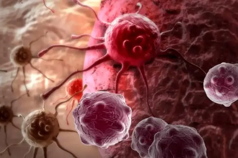 Testicular Cancer Symptoms: Lump Guide