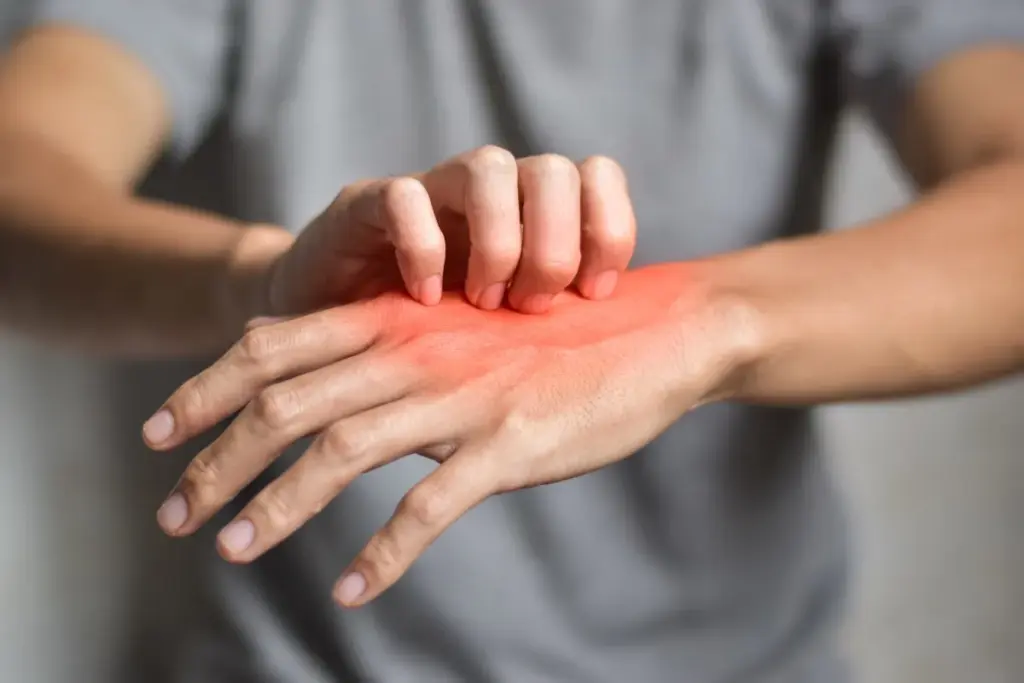 Can Autoimmune Disease Kill You? Best Facts